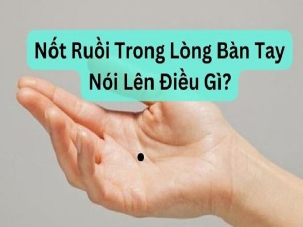 Xem bói nốt ruồi trong lòng bàn tay ở từng vị trí