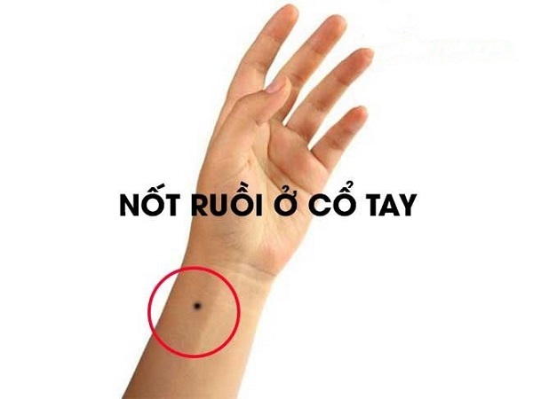 Luận nốt ruồi ở cổ tay trái