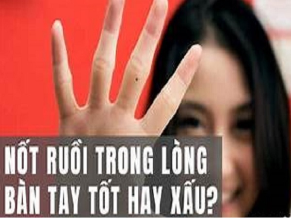 Ý nghĩa chung của nốt ruồi trong lòng bàn tay